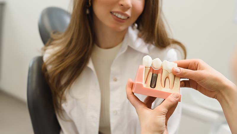 Dental Implants
